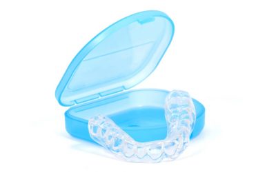 Wie wirkten Zahnschienen?