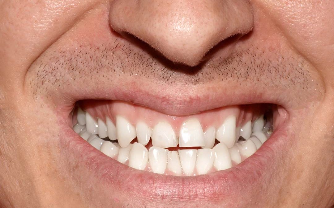 Eine Zahnärztin spricht Klartest: Was Deine Zähne über Dich verraten