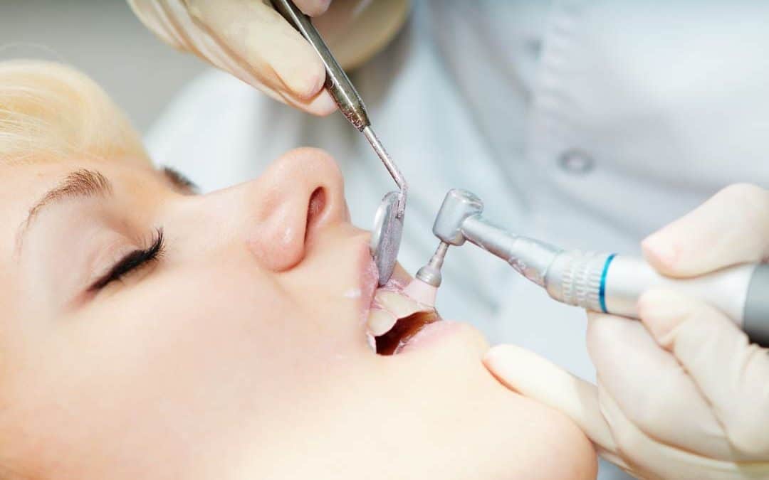 Wer braucht wie häufig eine professionelle Zahnreinigung beim Zahnarzt?