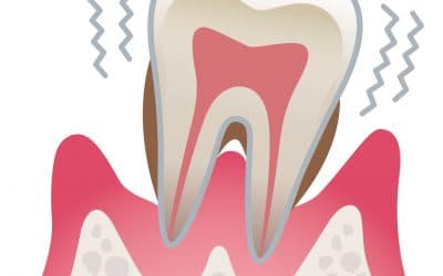 Was hat Dein Darm mit Deinem Zahnfleisch zu tun?